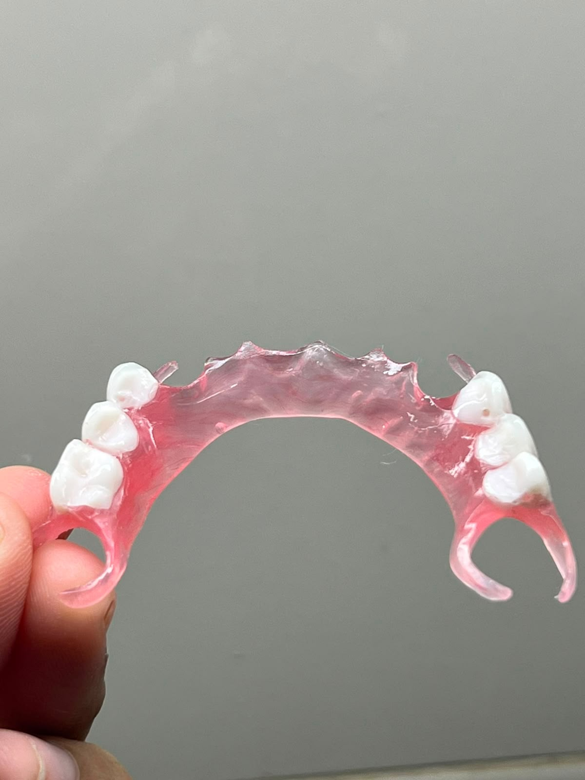 Prótese parcial removível flexível em resina rosa