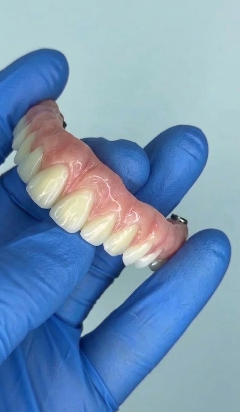Montagem de dentes